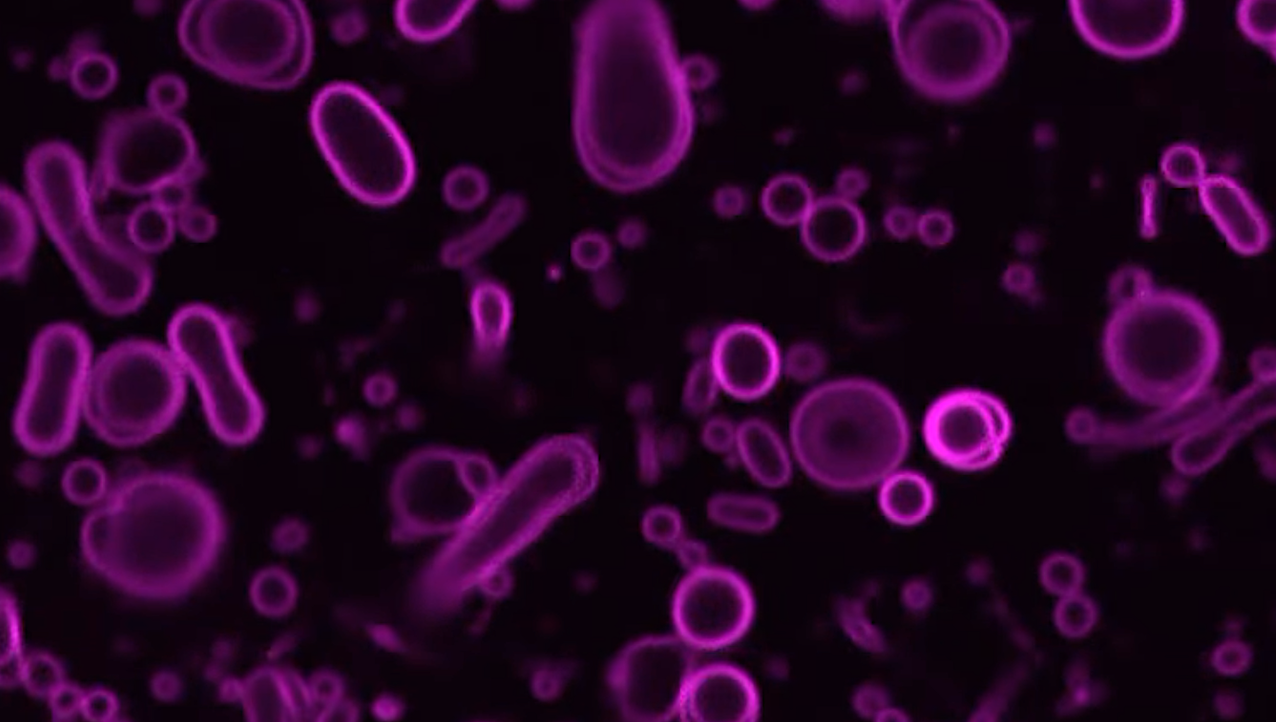 Fluorescence microscopy video showing vesicle formation -- University of California - San Diego