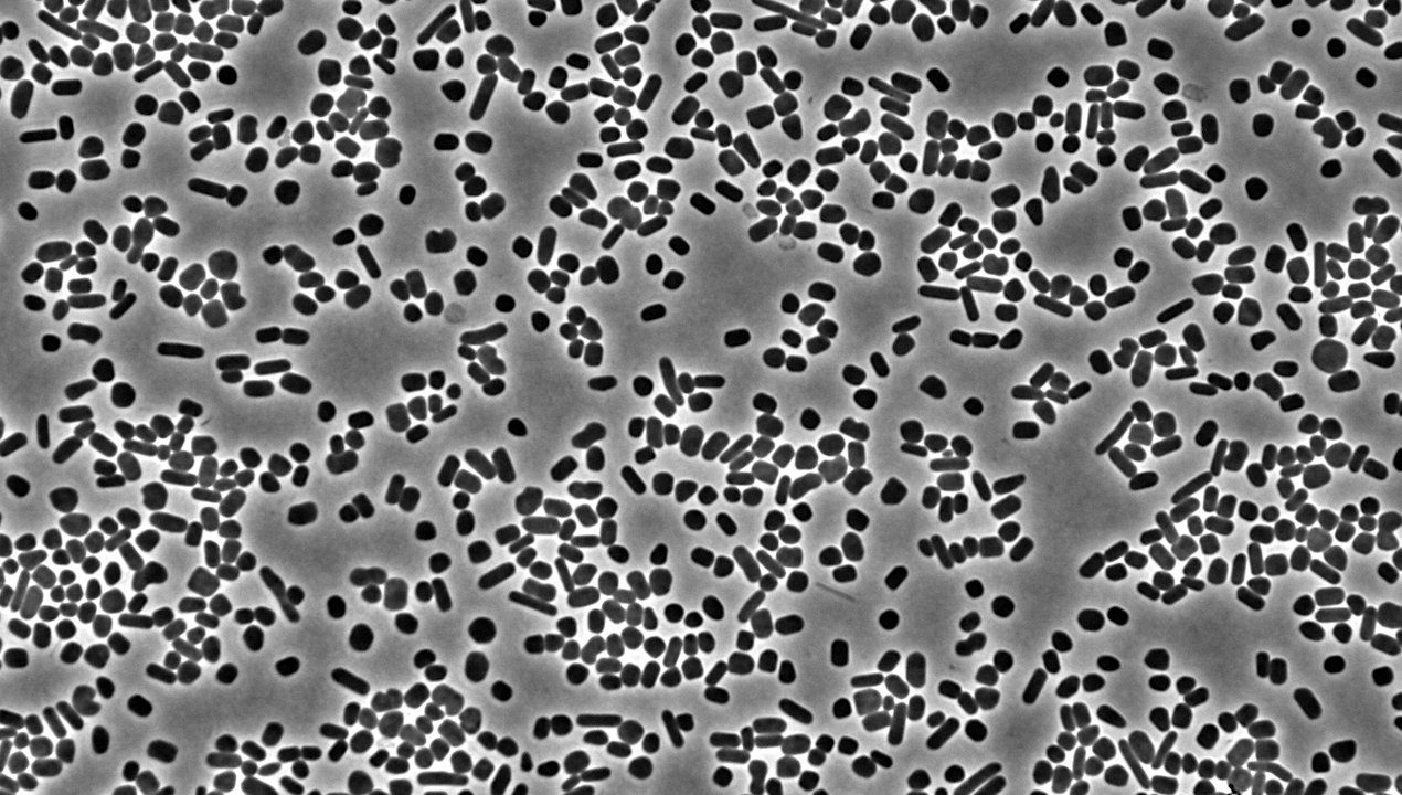 A lab-grown culture of Haloferax volcanii imaged under an agarose pad using phase contrast microscopy -- Wikipedia