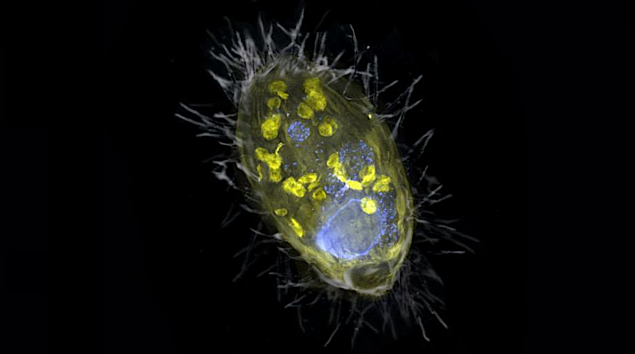 Illustration of the initially discovered endosymbiont ‘Candidatus Azoamicus ciliaticola’ and its ciliate host. The figure is a composite of a scanning electron microscope image (SEM, grey) and fluorescence images. Visible is the endosymbiont (yellow) and bacterial prey in food vacuoles as well as the large cell nucleus (blue). The outer structure of the weakly fluorescent ciliate as well as the cilia are also visible. Credit S. Ahmerkamp/Max Planck Institute for Marine Microbiology