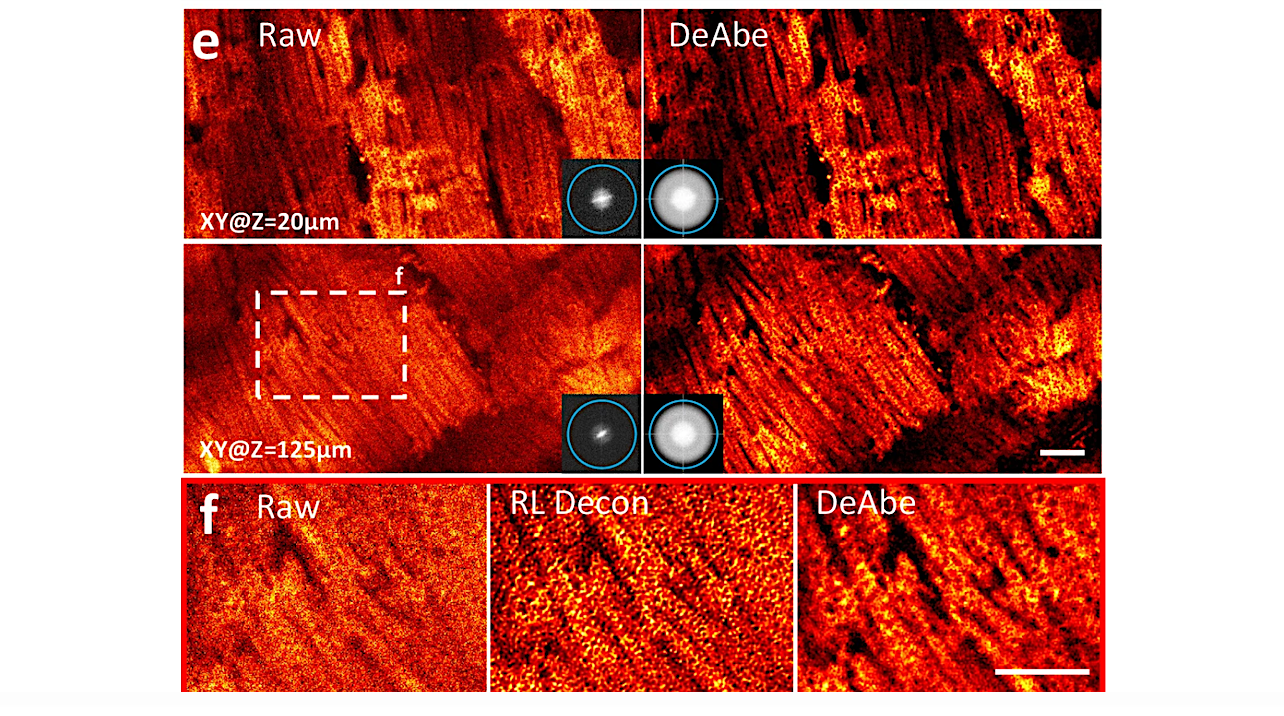 e. Live cardiac tissue containing cardiomyocytes expressing Tomm20-GFP was imaged with two photon microscopy. Raw data (left) are compared with DeAbe prediction (right) at indicated depths, with insets showing corresponding Fourier transform magnitudes. Blue circles in Fourier insets in (e) indicate 1/300 nm−1 spatial frequency just beyond resolution limit. -- Nature Communications Larger image