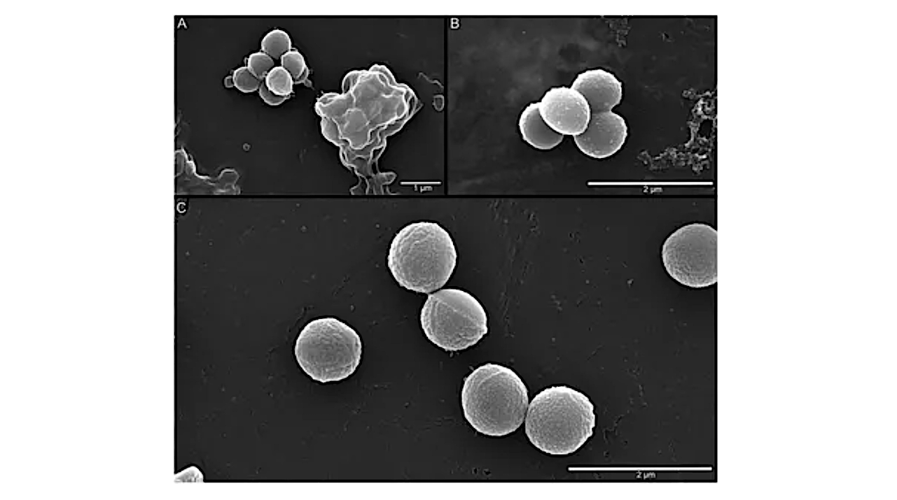 SEM images of A. agilis Ant-EH-1 grown at (A) 25 °C; (B) 5 °C; (C) −5 °C. -- Frontiers via PubMed