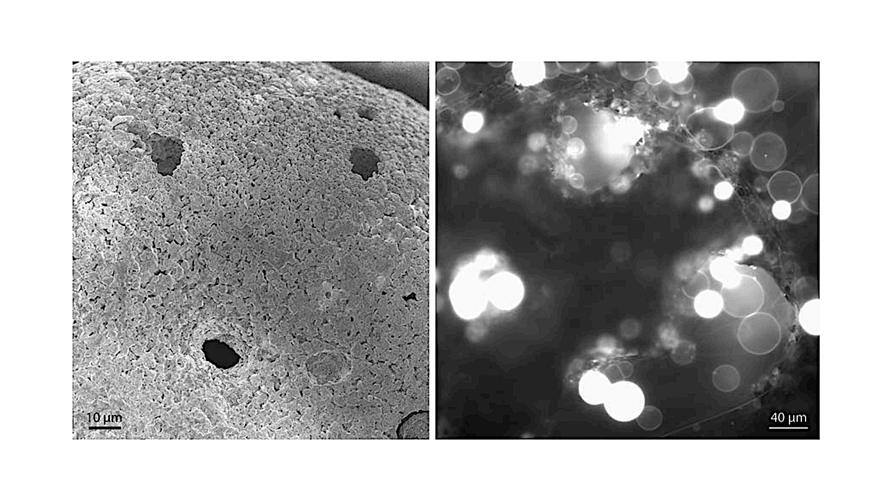 Protocell formation on a scoriaceous micrometeorite. A scanning electron microscope image section of the micrometeorite (left), fluorescence microscope micrograph of protocells on the surface of the micrometeorite (right). Phospholipid membranes in the fluorescence micrograph are composed of Escherichia coli (E.coli) and soybean plant lipids, labeled with 1 wt% ATTO 655-DOPE. Unilamellar vesicles have only a thin fluorescent rim, while multilamellar membrane reservoirs are onion shell vesicles composed of densely packed lipid membranes. -- Astrobiology