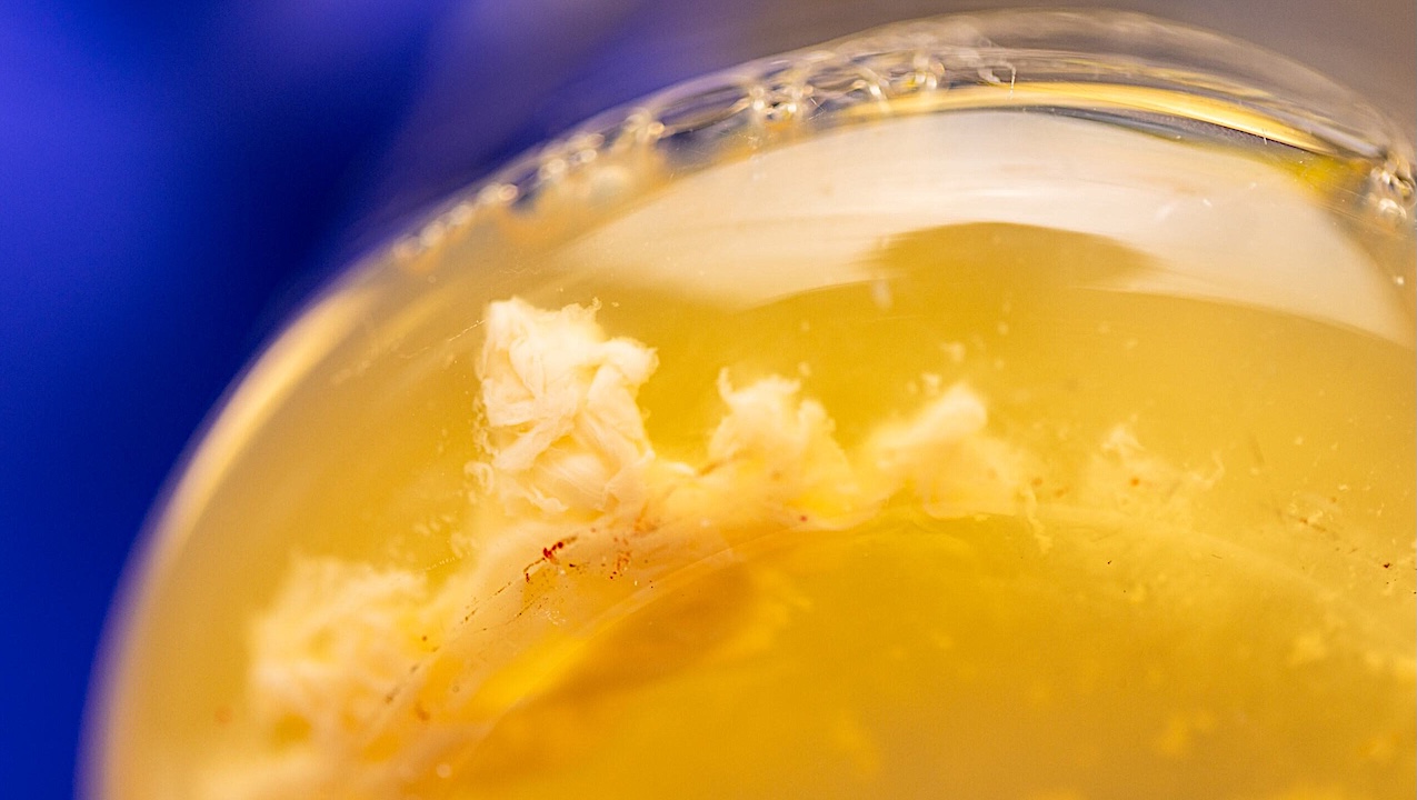 Biofilms, shown here, are structured communities of microorganisms that could be important to space exploration.